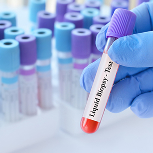 Liquid biopsy