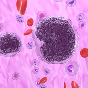 non-hodgkin-lymphoma