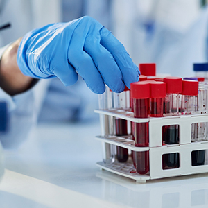 Pediatric hematology