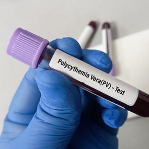 Polycythemia
